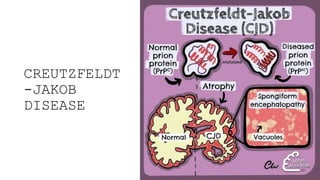 CREUTZFELDT
-JAKOB
DISEASE
 