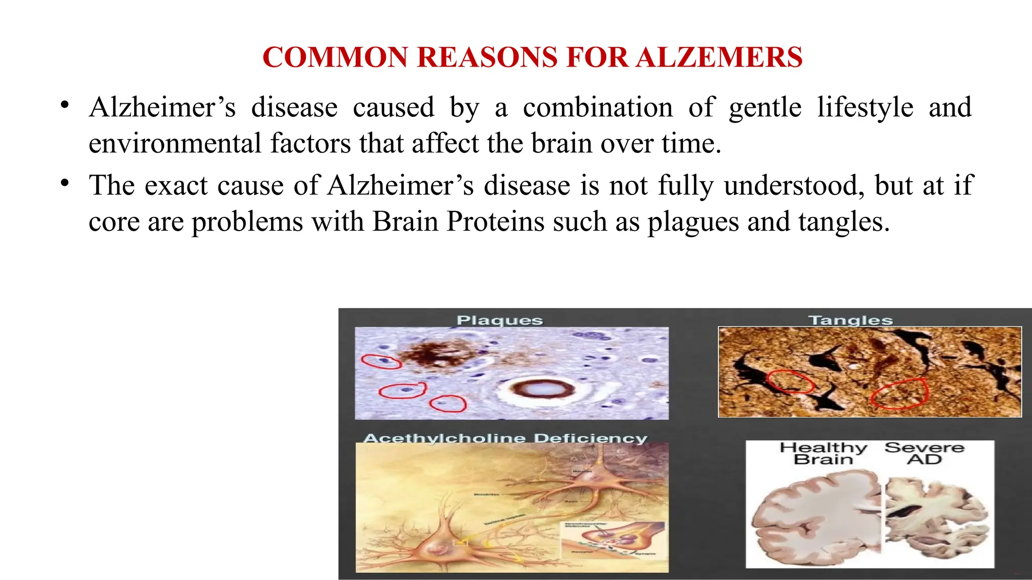 COMMON REASONS FOR ALZEMERS
• Alzheimer’s disease caused by a combination of gentle lifestyle and
environmental factors that affect the brain over time.
• The exact cause of Alzheimer’s disease is not fully understood, but at if
core are problems with Brain Proteins such as plagues and tangles.
 