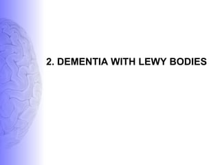 2. DEMENTIA WITH LEWY BODIES
 