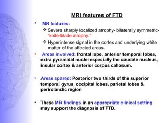 MRI features of FTD
• MR features:
 Severe sharply localized atrophy- bilaterally symmetric-
“knife-blade atrophy.”
 Hyperintense signal in the cortex and underlying white
matter of the affected areas.
• Areas involved: frontal lobe, anterior temporal lobes,
extra pyramidal nuclei especially the caudate nucleus,
insular cortex & anterior corpus callosum.
• Areas spared: Posterior two thirds of the superior
temporal gyrus, occipital lobes, parietal lobes &
perirolandic region
• These MR findings in an appropriate clinical setting
may support the diagnosis of FTD.
 