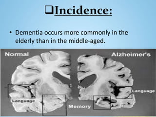 Incidence:
• Dementia occurs more commonly in the
elderly than in the middle-aged.
 