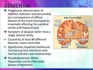 Progressive deterioration of intellect, behavior and personality as a consequence of diffuse disease of the brain hemispheres, maximally affecting the cerebral cortex and hippocampus   S ymptom of disease rather than a single disease entity   Caused by at least 80 different diseases, many reversible Significantly impaired intellectual functioning that interferes with normal activities and relationships Pseudodementia : When  Depression mimic s  the initial phases of dementi a 