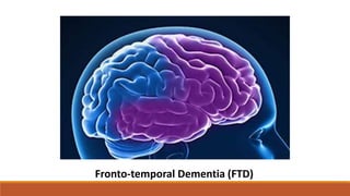 Fronto-temporal Dementia (FTD)
 