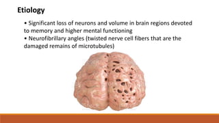 Etiology
• Significant loss of neurons and volume in brain regions devoted
to memory and higher mental functioning
• Neurofibrillary angles (twisted nerve cell fibers that are the
damaged remains of microtubules)
 