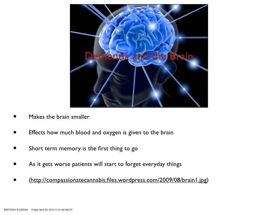 Images of brain affected by dementia