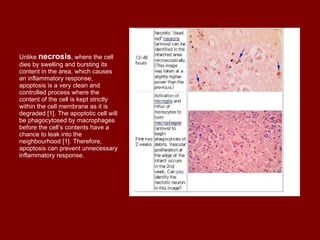 Unlike  necrosis , where the cell dies by swelling and bursting its content in the area, which causes an inflammatory response, apoptosis is a very clean and controlled process where the content of the cell is kept strictly within the cell membrane as it is degraded [1]. The apoptotic cell will be phagocytosed by macrophages before the cell’s contents have a chance to leak into the neighbourhood [1]. Therefore, apoptosis can prevent unnecessary inflammatory response. 