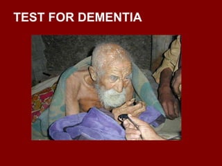 TEST FOR DEMENTIA 