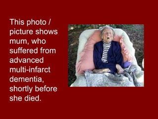 This photo / picture shows mum, who suffered from advanced multi-infarct dementia, shortly before she died.   