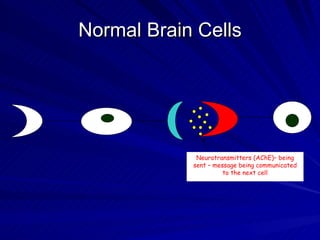 Normal Brain Cells




             Neurotransmitters (AChE)– being
            sent – message being communicated
                      to the next cell
 