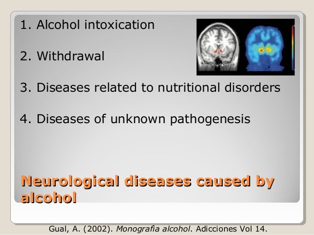 Alcoholic Dementia Symptoms , Alcoholic Dementia: Symptoms, Progression ...