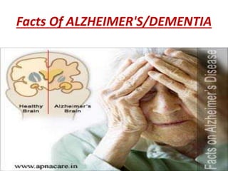 Facts Of ALZHEIMER'S/DEMENTIA 
 