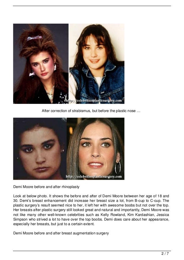 Demi Moore Plastic Surgery Before And After Photos