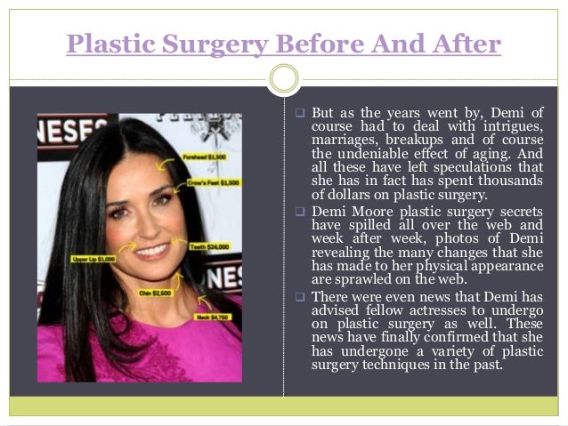 Demi Moore Plastic Surgery