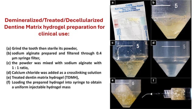 Demineralized dentine matrix uses in paediatric dentistry - final ...