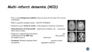  This is an overdiagnosed condition which accounts for less than 10% of cases
of dementia.
 MID is caused by multiple strokes - SILENT STROKES
 Dementia occurs ’stroke by stroke‘, with progressive focal loss of function.
 Clinical features of stroke profile – hypertension, diabetes, etc. – are present.
More often in males.
 Diagnosis is obtained from the history and
confirmed by CT or MRI scan (the presence
of multiple areas of infarction).
 Treatment: Maintain adequate blood pressure control,
anti-platelet aggregants (aspirin).
 