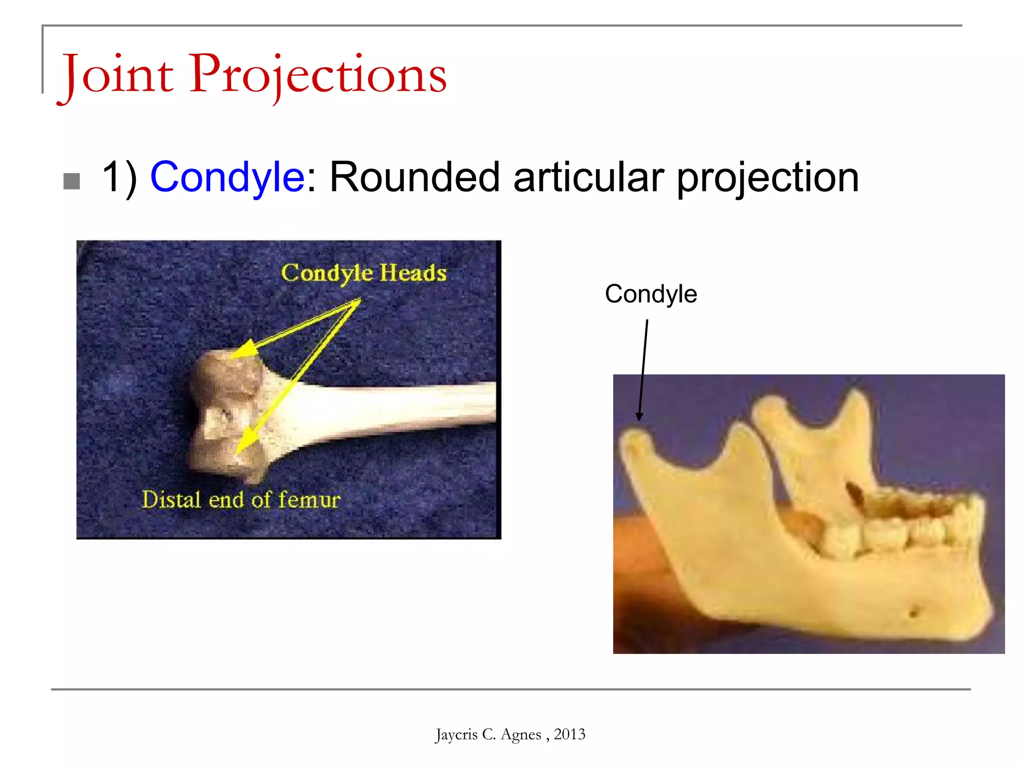 Joint Projections
 1) Condyle: Rounded articular projection
Condyle
Jaycris C. Agnes , 2013
 