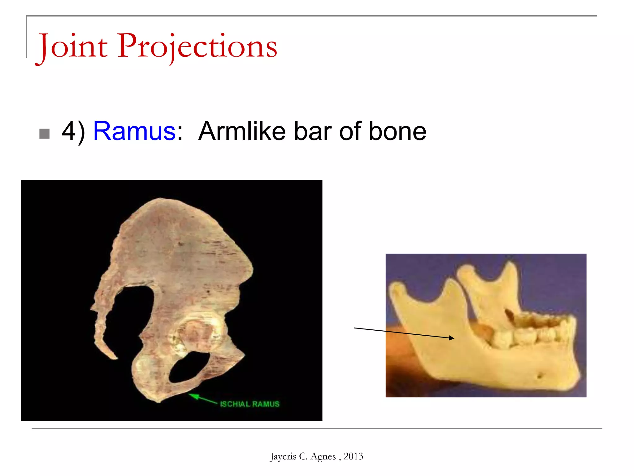 Joint Projections
 4) Ramus: Armlike bar of bone
Jaycris C. Agnes , 2013
 