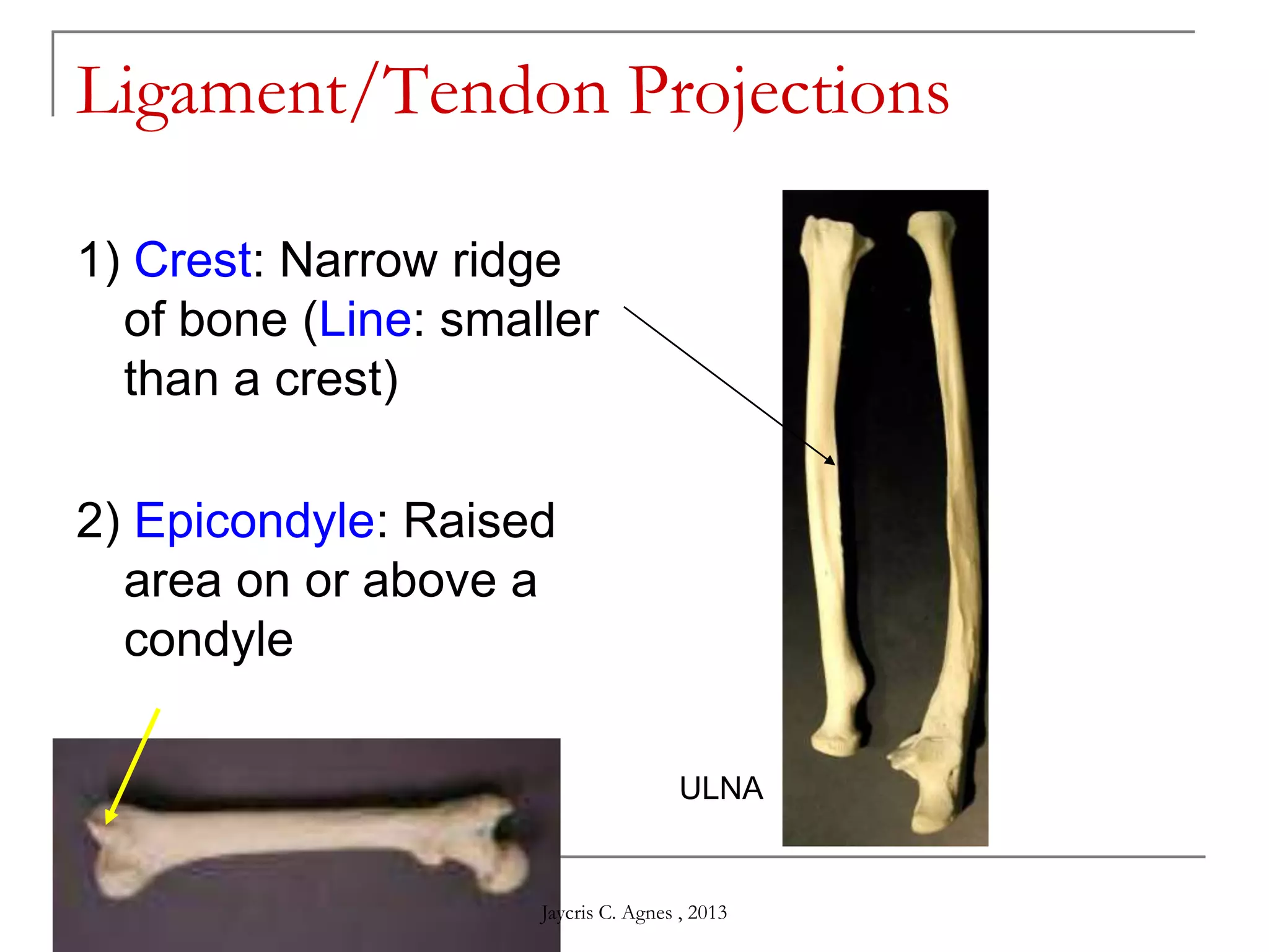 Ligament/Tendon Projections
1) Crest: Narrow ridge
of bone (Line: smaller
than a crest)
2) Epicondyle: Raised
area on or above a
condyle
ULNA
Jaycris C. Agnes , 2013
 