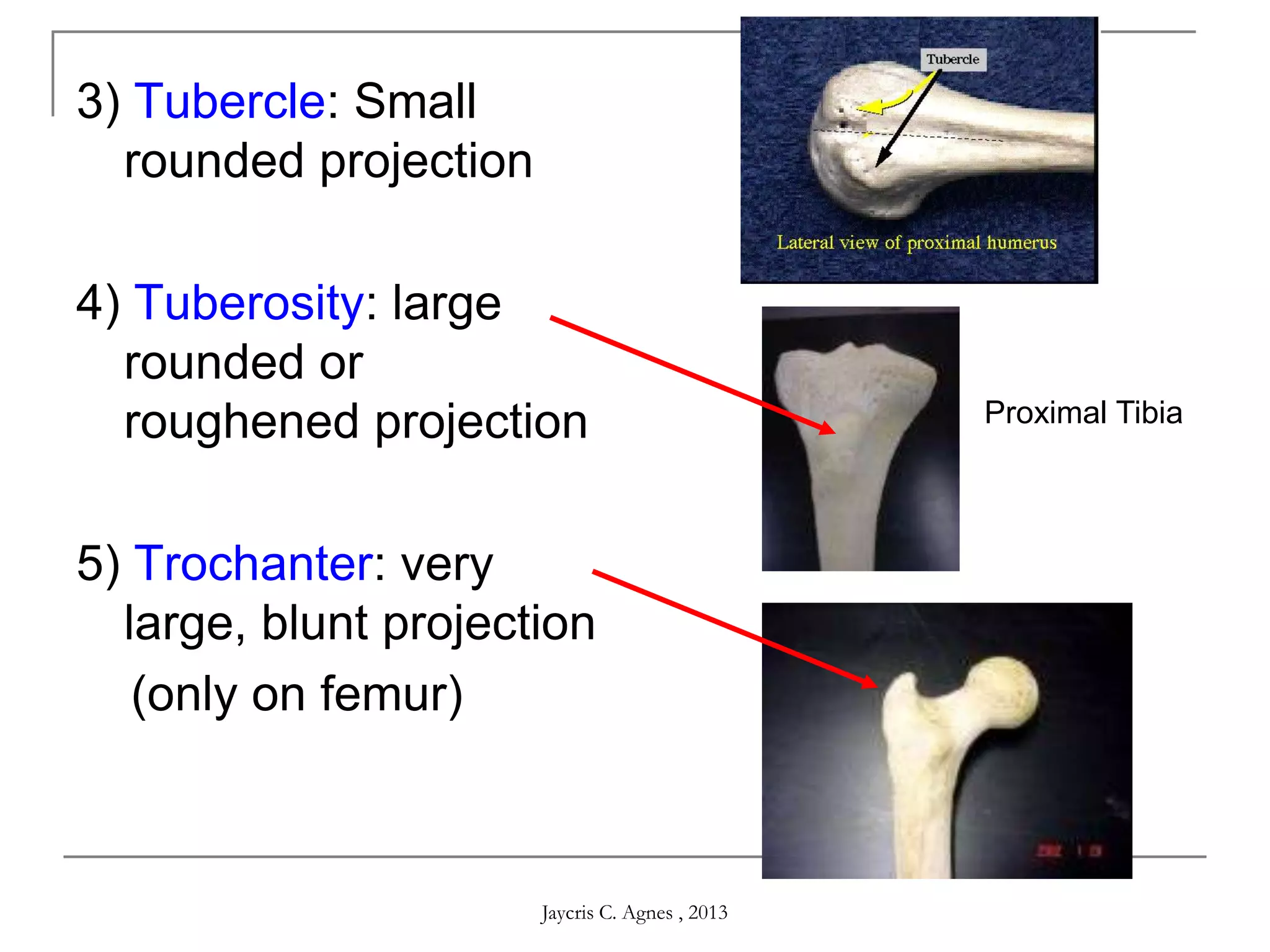 3) Tubercle: Small
rounded projection
4) Tuberosity: large
rounded or
roughened projection
5) Trochanter: very
large, blunt projection
(only on femur)
Proximal Tibia
Jaycris C. Agnes , 2013
 