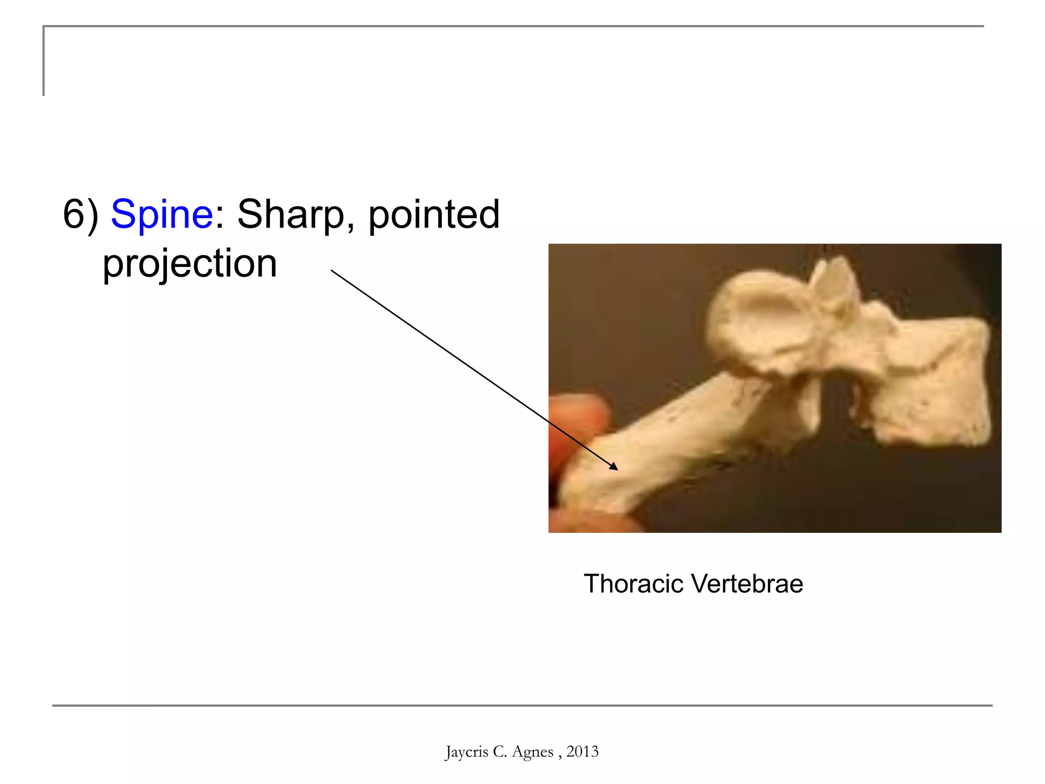 6) Spine: Sharp, pointed
projection
Thoracic Vertebrae
Jaycris C. Agnes , 2013
 