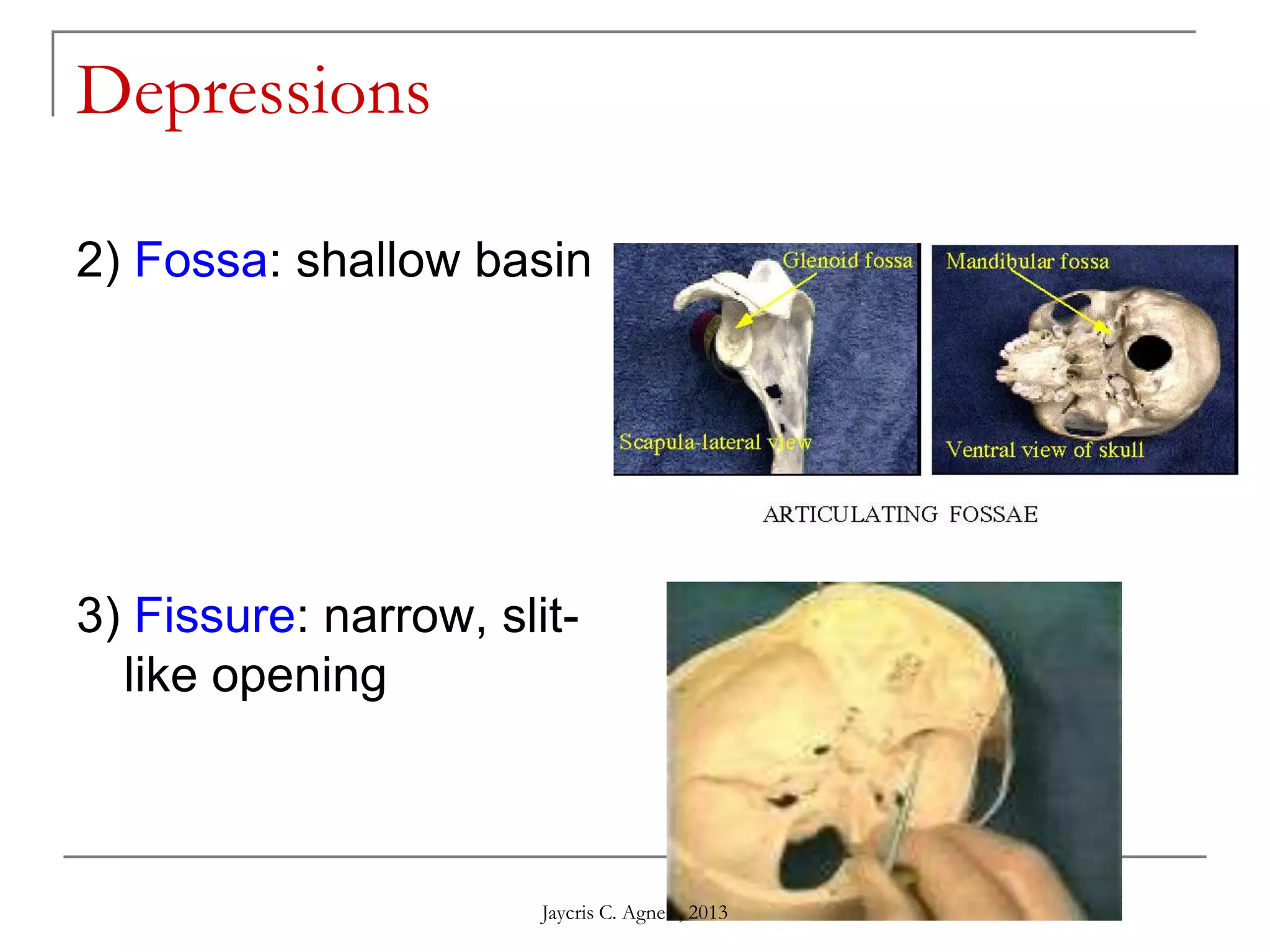 Depressions
2) Fossa: shallow basin
3) Fissure: narrow, slit-
like opening
Jaycris C. Agnes , 2013
 