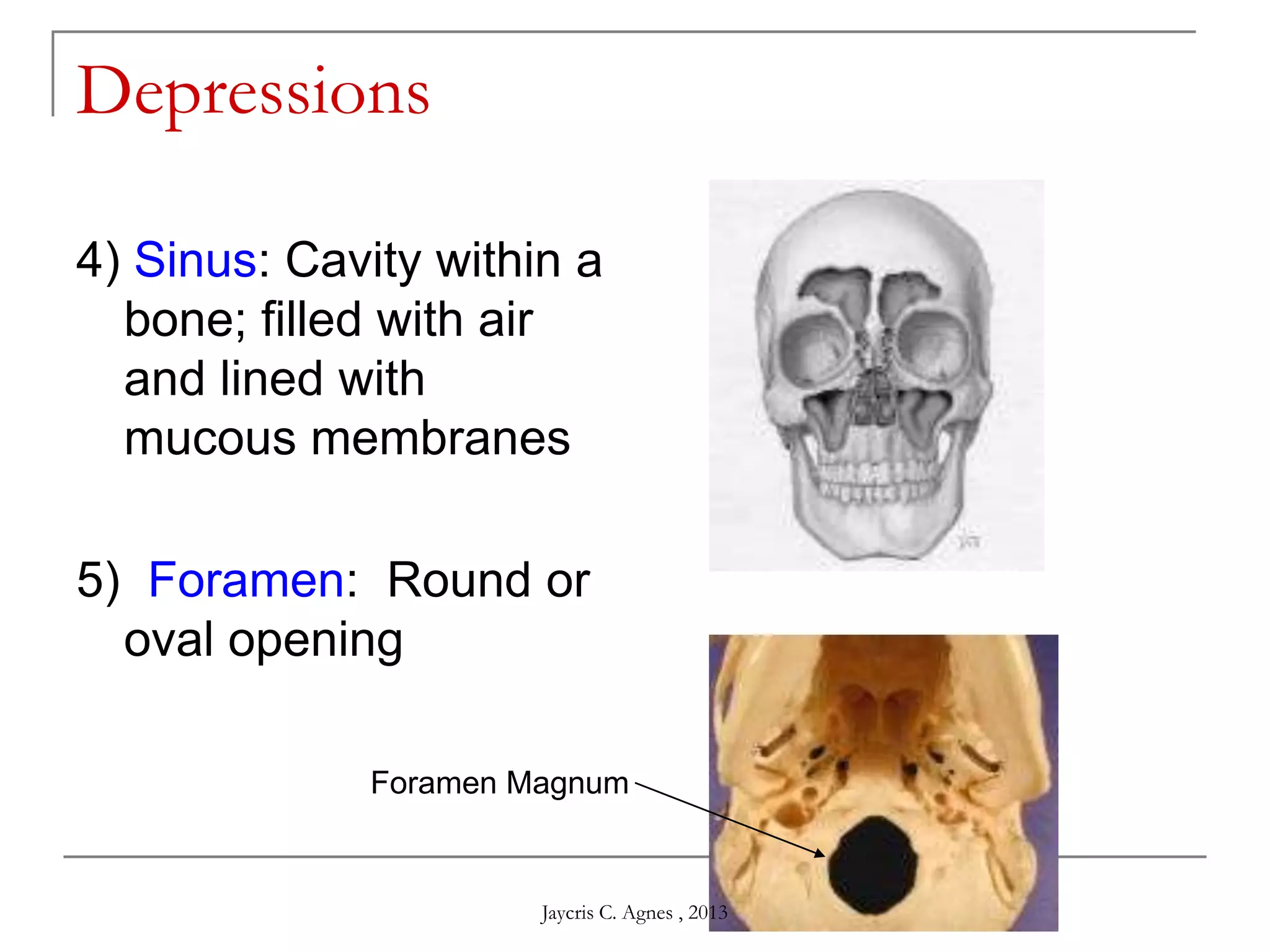 Depressions
4) Sinus: Cavity within a
bone; filled with air
and lined with
mucous membranes
5) Foramen: Round or
oval opening
Foramen Magnum
Jaycris C. Agnes , 2013
 