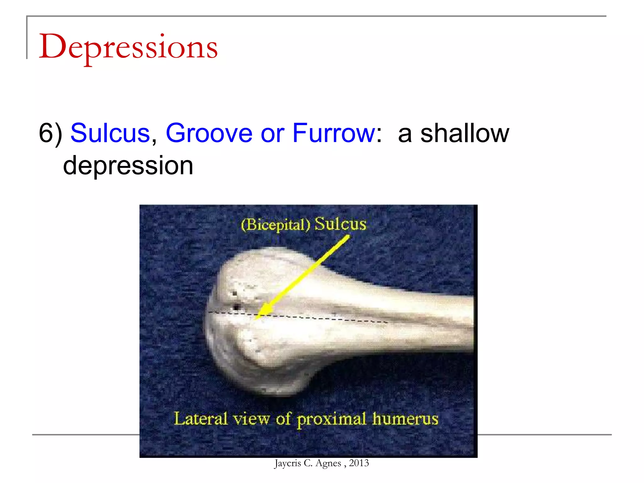 Depressions
6) Sulcus, Groove or Furrow: a shallow
depression
Jaycris C. Agnes , 2013
 