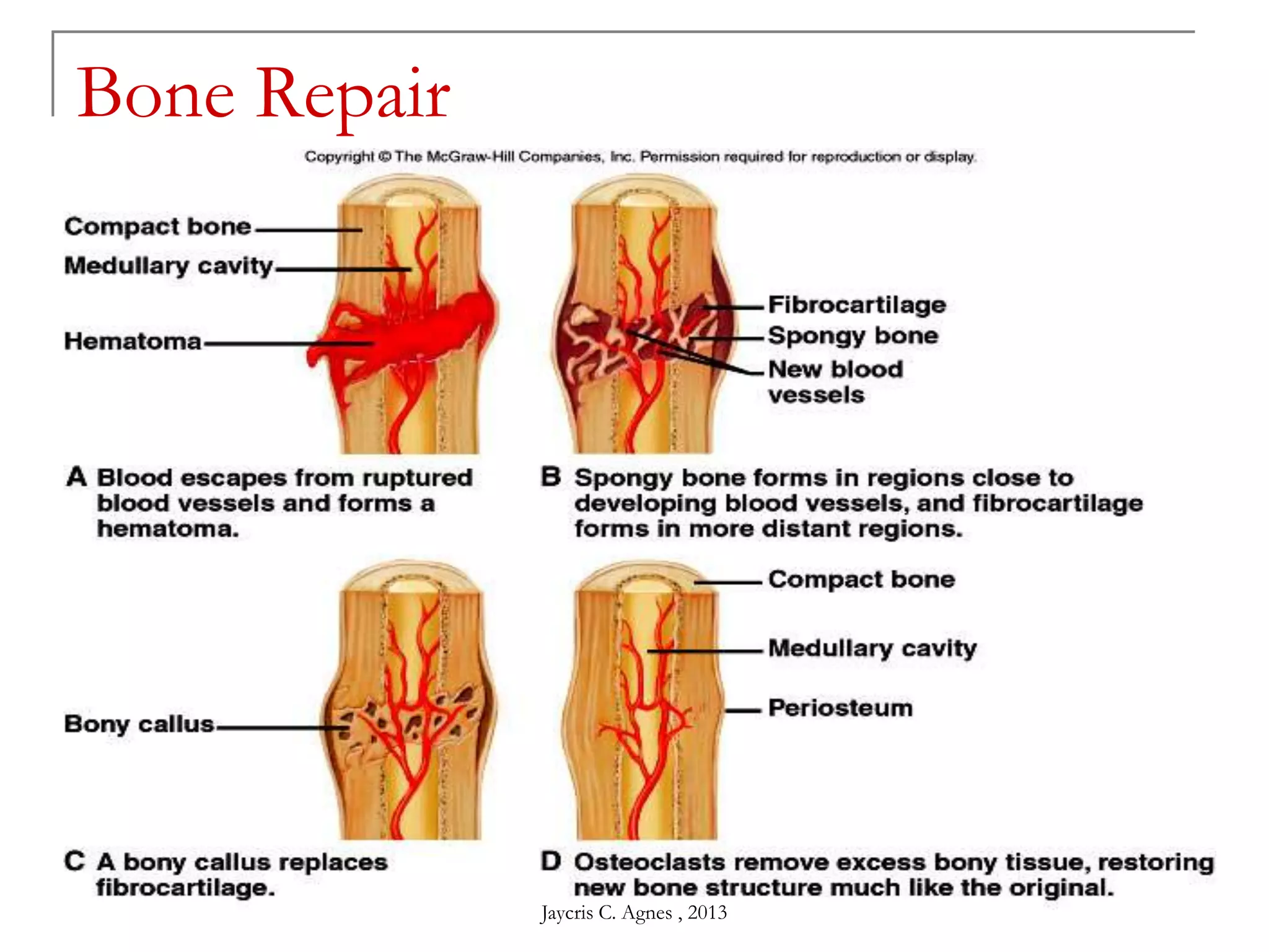 Bone Repair
Jaycris C. Agnes , 2013
 