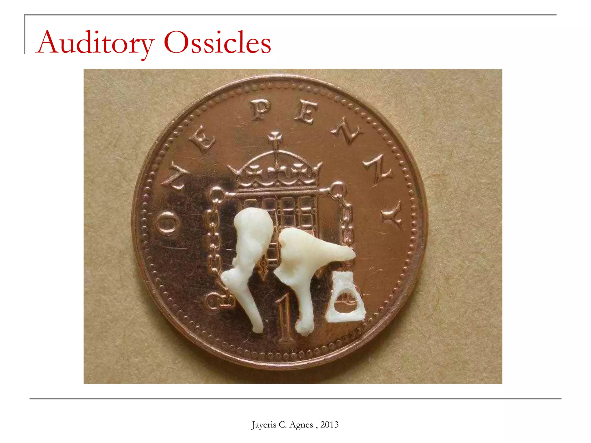 Auditory Ossicles
Jaycris C. Agnes , 2013
 