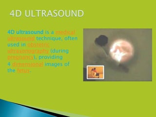 4D ultrasound is a medical
ultrasound technique, often
used in obstetric
ultrasonography (during
pregnancy), providing
4 dimensional images of
the fetus.
 