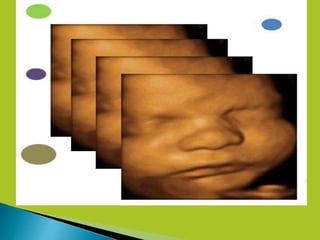 4D Ultrasound Technology