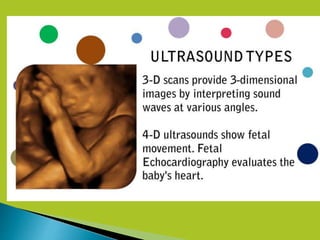 4D Ultrasound Technology