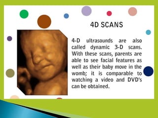 4D Ultrasound Technology