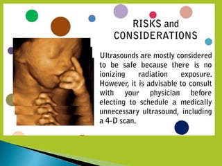 4D Ultrasound Technology