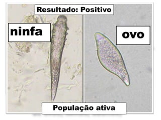 Resultado: Positivo


ninfa
SANGUE CAPILAR
                            ovo
   RASPADO
                       Potassa 10%
                           3 - 5’
                           M.O



    (+) População ativa (presença
          População ativa
    de ovos, ninfas, adultos)
 