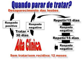 Desaparecimento das lesões


                            Repetir/15 dias
Raspado
             Raspado
positivo                        Raspado
             negativo
      Tratar +                  negativo
      30 dias
                           Repetir/15 dias

                                Raspado
                                negativo

   Sem tratar/sem recidiva: 12 meses
 