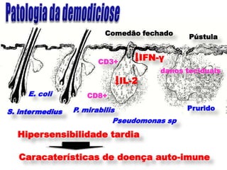Comedão fechado
                                                Pústula


                       CD3+
                                     IFN-γ
                                         danos teciduais
                              IL-2
     E. coli        CD8+

                 P. mirabilis                  Prurido
S. intermedius
                             Pseudomonas sp
  Hipersensibilidade tardia

   Caracaterísticas de doença auto-imune
 