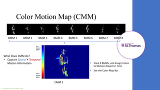 Real-Time Motion Detection | PPTX