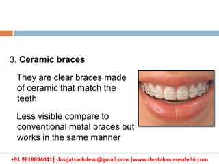 +91 9818894041| drrajatsachdeva@gmail.com |www.dentalcoursesdelhi.com
3. Ceramic braces
They are clear braces made
of ceramic that match the
teeth
Less visible compare to
conventional metal braces but
works in the same manner
 