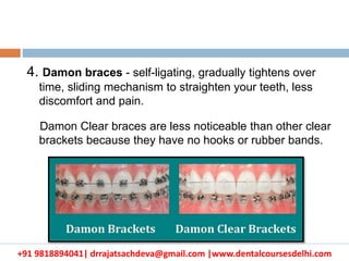 +91 9818894041| drrajatsachdeva@gmail.com |www.dentalcoursesdelhi.com
4. Damon braces - self-ligating, gradually tightens over
time, sliding mechanism to straighten your teeth, less
discomfort and pain.
Damon Clear braces are less noticeable than other clear
brackets because they have no hooks or rubber bands.
 