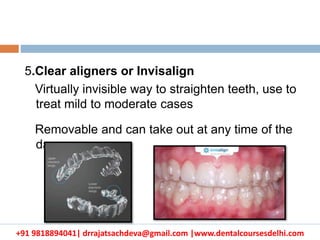 +91 9818894041| drrajatsachdeva@gmail.com |www.dentalcoursesdelhi.com
5.Clear aligners or Invisalign
Virtually invisible way to straighten teeth, use to
treat mild to moderate cases
Removable and can take out at any time of the
day
 