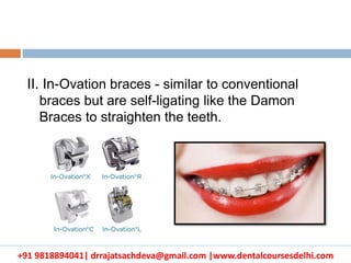 +91 9818894041| drrajatsachdeva@gmail.com |www.dentalcoursesdelhi.com
II. In-Ovation braces - similar to conventional
braces but are self-ligating like the Damon
Braces to straighten the teeth.
 