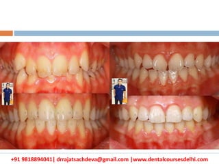 +91 9818894041| drrajatsachdeva@gmail.com |www.dentalcoursesdelhi.com
 