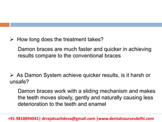 +91 9818894041| drrajatsachdeva@gmail.com |www.dentalcoursesdelhi.com
 How long does the treatment takes?
Damon braces are much faster and quicker in achieving
results compare to the conventional braces
 As Damon System achieve quicker results, is it harsh or
unsafe?
Damon braces work with a sliding mechanism and makes
the teeth moves slowly, gently and naturally causing less
deterioration to the teeth and enamel
 