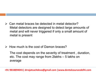+91 9818894041| drrajatsachdeva@gmail.com |www.dentalcoursesdelhi.com
 Can metal braces be detected in metal detector?
Metal detectors are designed to detect large amounts of
metal and will never triggered if only a small amount of
metal is present
 How much is the cost of Damon braces?
The cost depends on the severity of treatment , duration,
etc. The cost may range from 2lakhs – 5 lakhs on
average
 