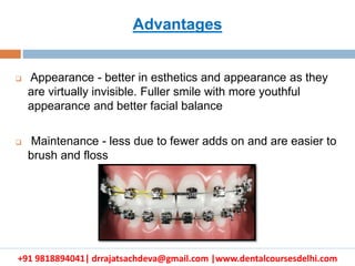 +91 9818894041| drrajatsachdeva@gmail.com |www.dentalcoursesdelhi.com
 Appearance - better in esthetics and appearance as they
are virtually invisible. Fuller smile with more youthful
appearance and better facial balance
 Maintenance - less due to fewer adds on and are easier to
brush and floss
Advantages
 