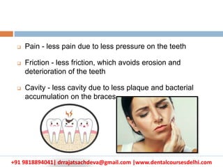 +91 9818894041| drrajatsachdeva@gmail.com |www.dentalcoursesdelhi.com
 Pain - less pain due to less pressure on the teeth
 Friction - less friction, which avoids erosion and
deterioration of the teeth
 Cavity - less cavity due to less plaque and bacterial
accumulation on the braces
 