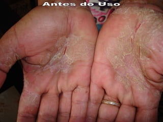 Antes do Uso 