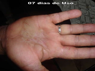 07 dias de Uso 
