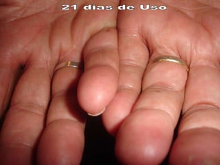 21 dias de Uso 